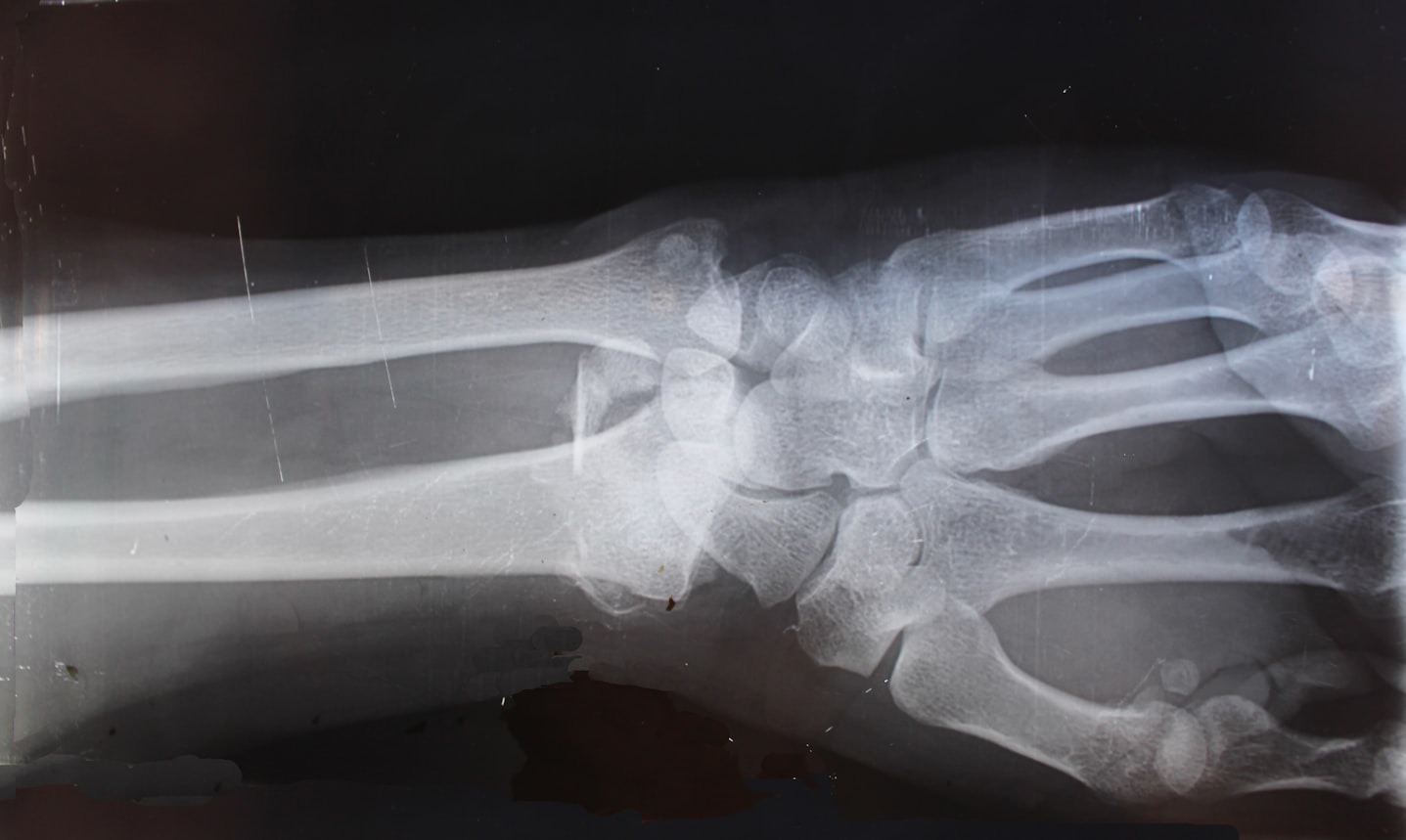 Voorbeeld van een röntgenfoto