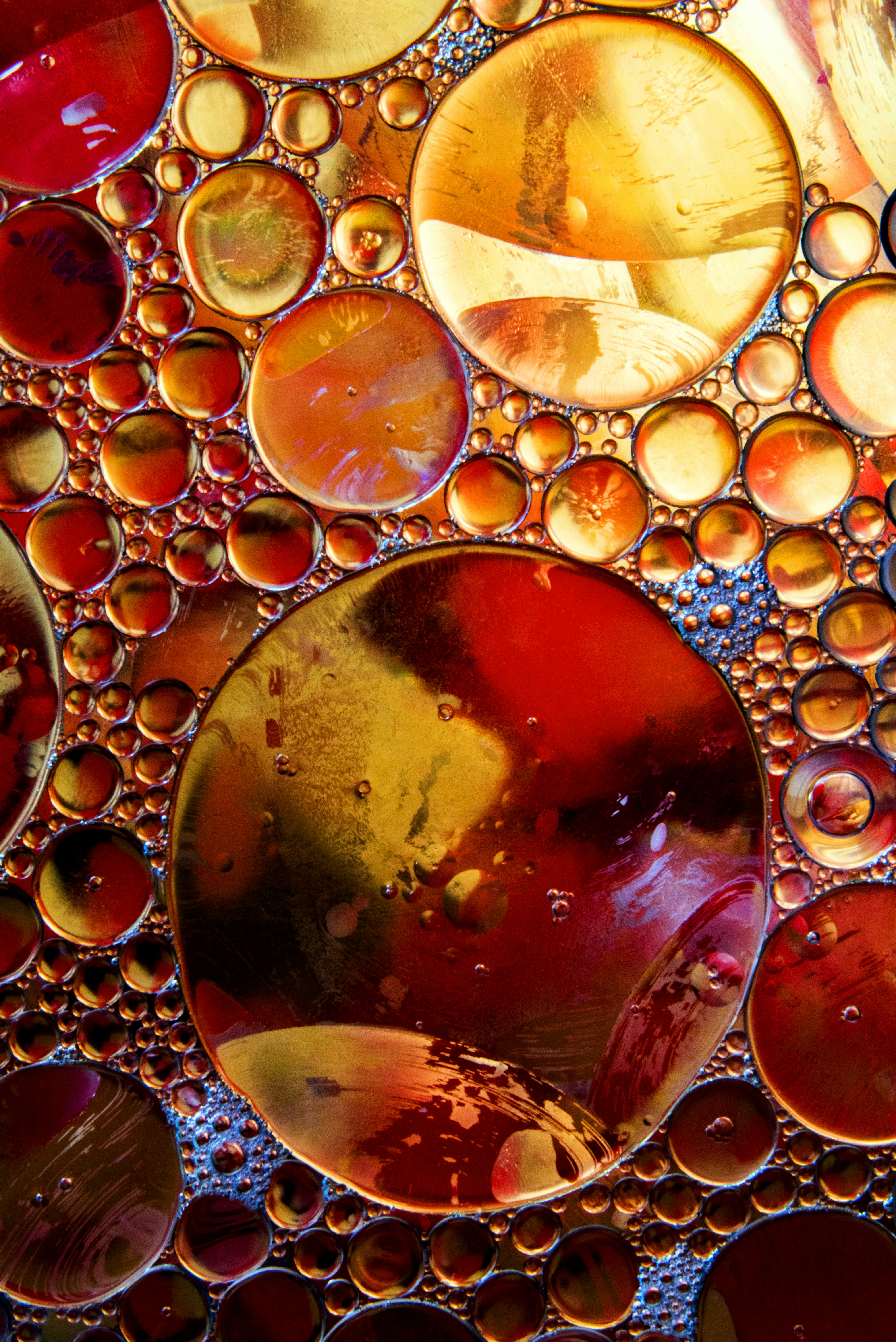 What Is The Role Of Uric Acid In Gout?