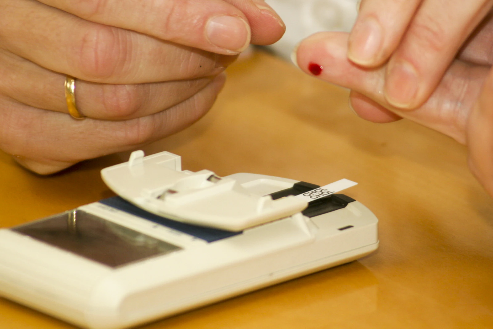 A bead of blood on a fingertip held above a glucose meter with a test strip inserted