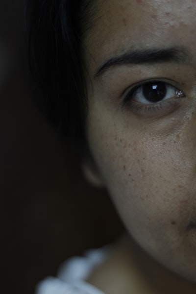 Skin before medical facial showing dullness