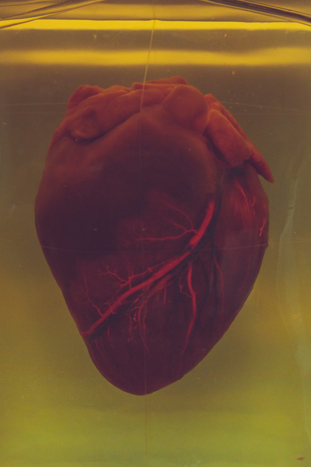 coração humano