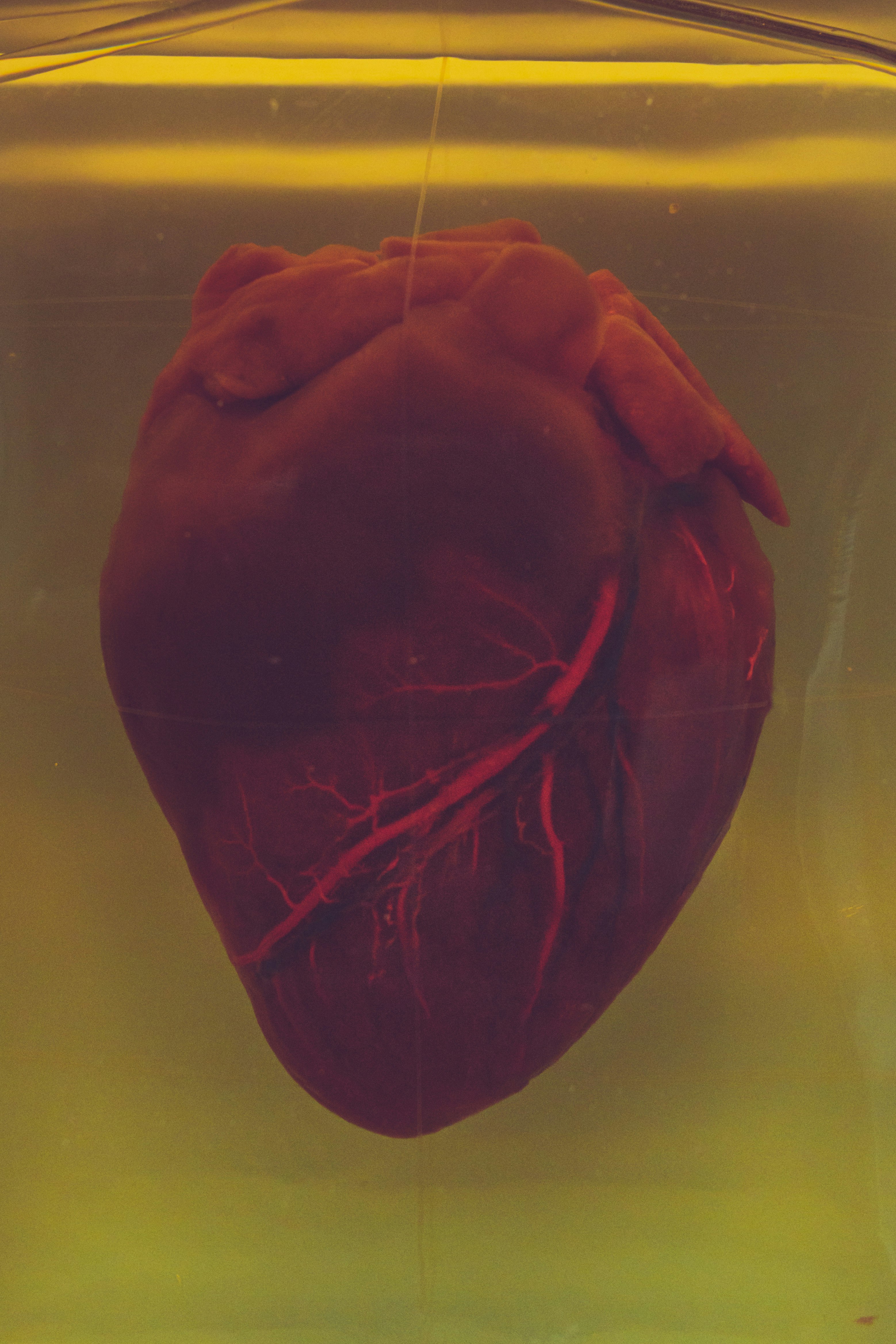 A real human heart inside a jar