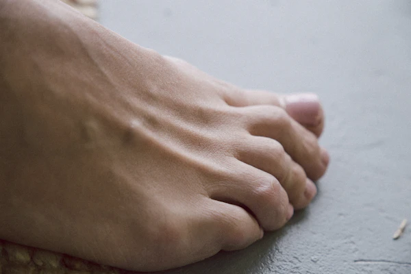 Alcoholic Peripheral Neuropathy
