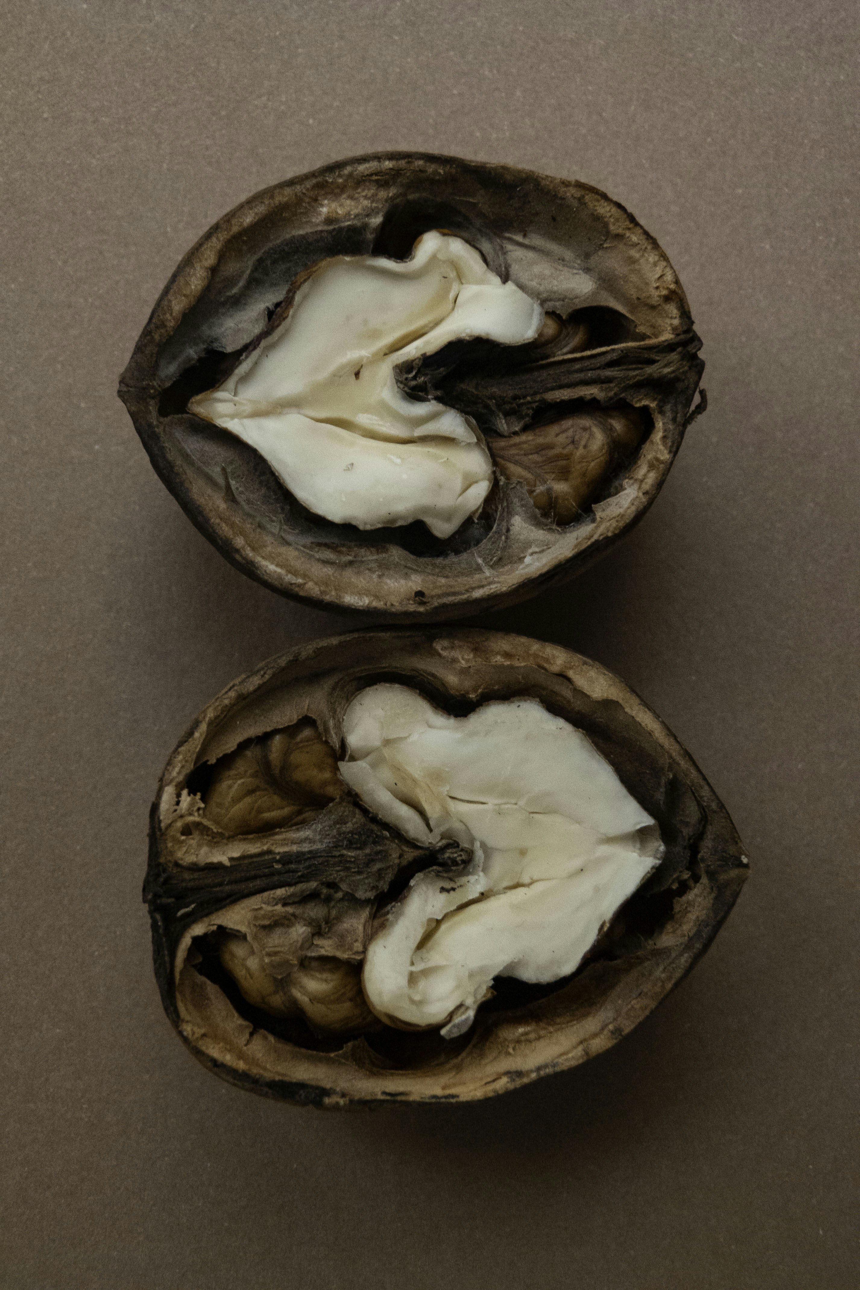 How bad is your BPH?