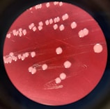 Circular colonies with a smooth, shiny appearance are scattered across a reddish background, typical of a petri dish surface. The colonies are uniformly distributed with slight variations in size.