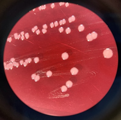 Circular colonies with a smooth, shiny appearance are scattered across a reddish background, typical of a petri dish surface. The colonies are uniformly distributed with slight variations in size.
