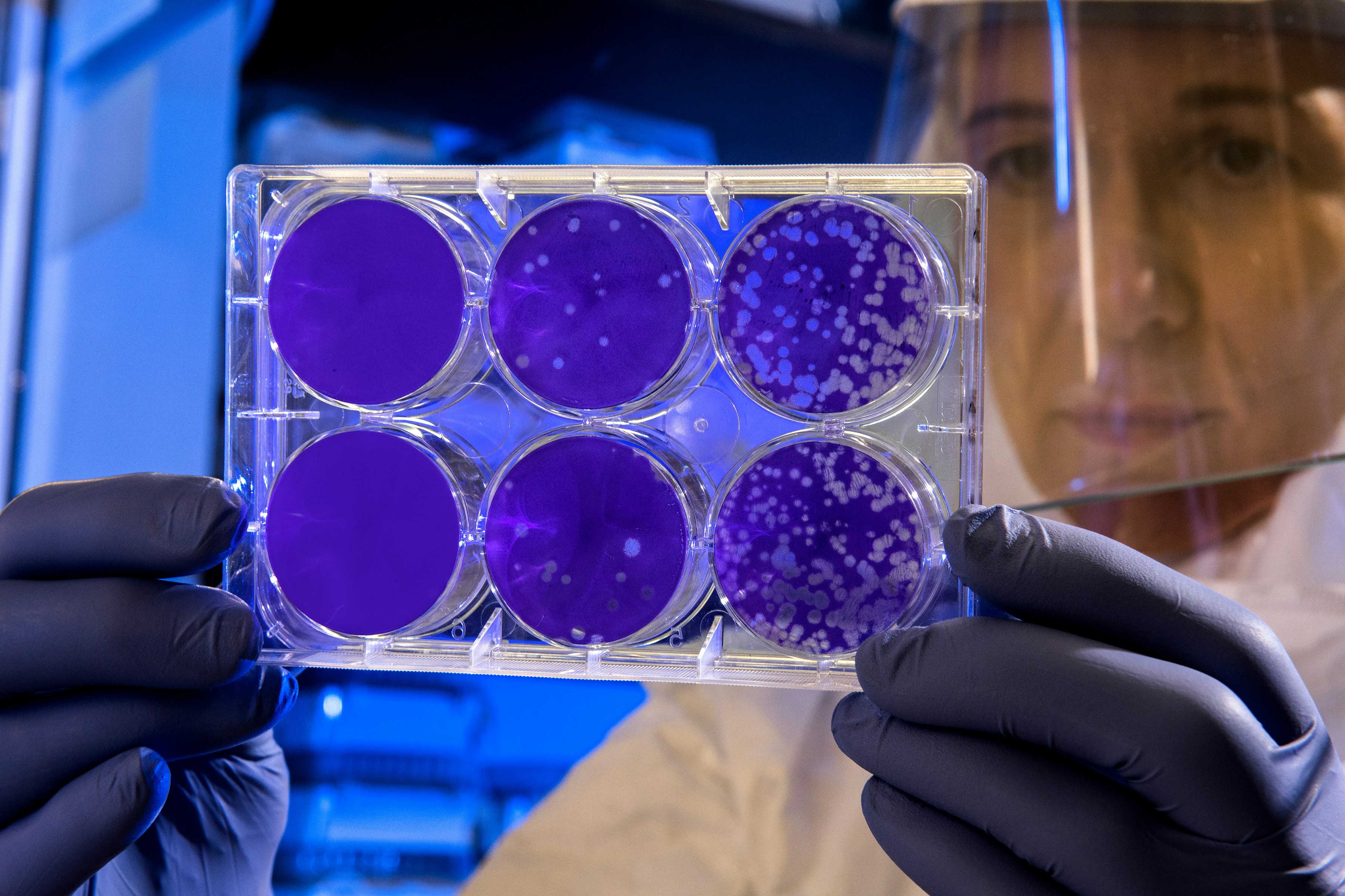 &quot;Scientist examines the result of a plaque assay, which is a test that allows scientists to count how many flu virus particles (virions) are in a mixture. To perform the test, scientists must first grow host cells that attach to the bottom of the plate, and then add viruses to each well so that the attached cells may be infected. After staining the uninfected cells purple, the scientist can count the clear spots on the plate, each representing a single virus particle.&quot;