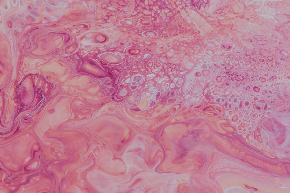 Basal Cell Carcinoma