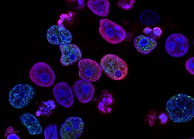 purple cells