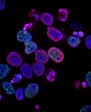 purple cells