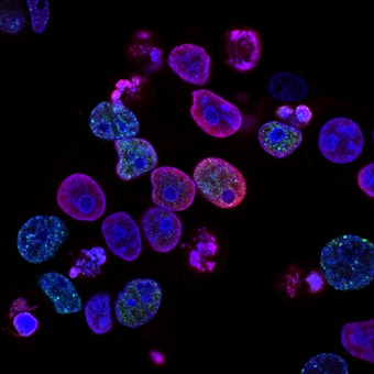 Brightly colored microscopic cells are highlighted against a dark background. The cells display a range of vivid colors including blues, pinks, and greens, indicating fluorescent staining techniques. Various cell structures and organelles are visible, emphasizing the intricate details of the biological samples.