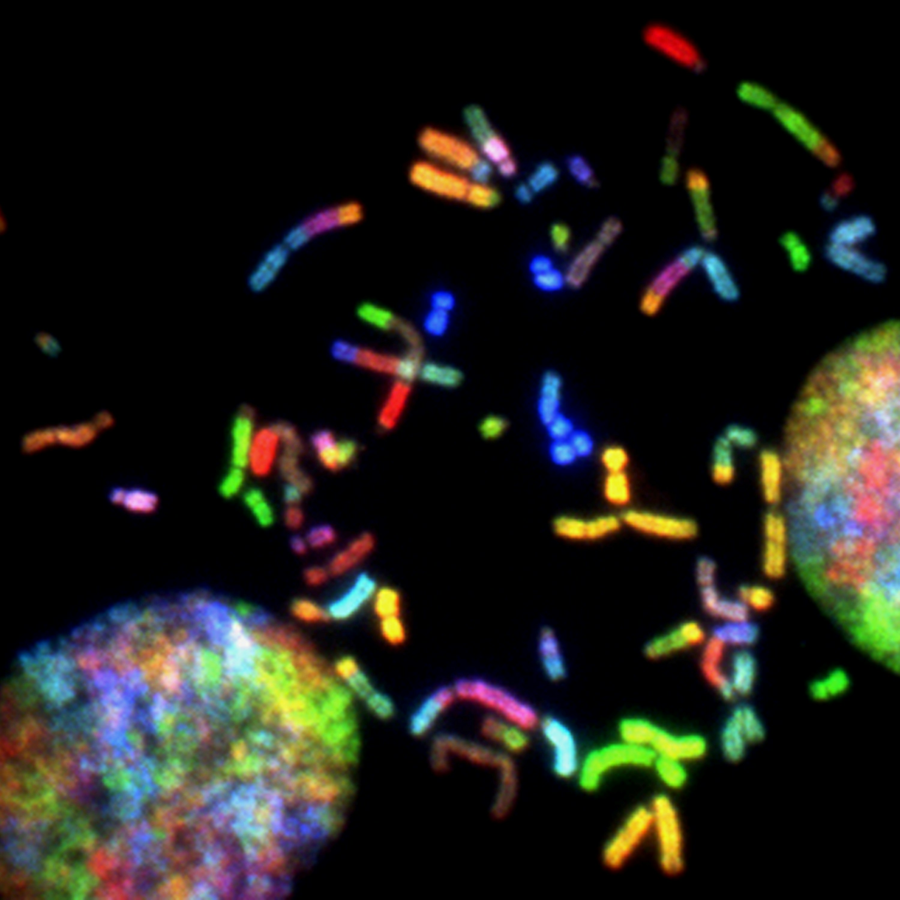 Brain Cancer Chromosomes. Chromosomes prepared from a malignant glioblastoma visualized by spectral karyotyping (SKY) reveal an enormous degree of chromosomal instability -- a hallmark of cancer. Created by Thomas Ried, 2014