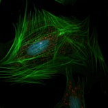 An intricate microscopic image of a cell with bright green fibrous structures surrounding a central blue nucleus. Scattered red dots are visible throughout the cell, illustrating a detailed and vibrant internal structure against a dark background.