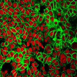 FDA approves immunotherapy that may spare some rectal cancer patients surgery, chemo, and radiation