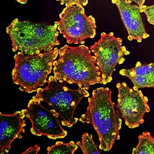 a close up of a cell phone case