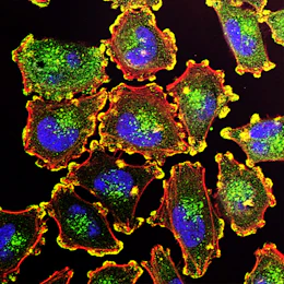 Cancer-promoting protein helps engineered T cells fight tumors in mice