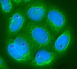 Microscopic view of several elliptical, blue structures with bright pink dots in the center, surrounded by a greenish background. The appearance suggests cell structures under a fluorescence microscope.