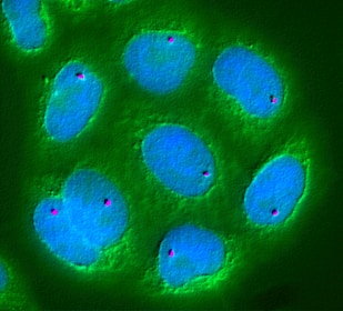 Microscopic view of several elliptical, blue structures with bright pink dots in the center, surrounded by a greenish background. The appearance suggests cell structures under a fluorescence microscope.