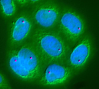 Microscopic view of mitochondrial structures glowing with fluorescent markers.