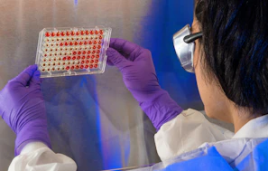 close-up photography of person holding a blood samples on clear plastic tray