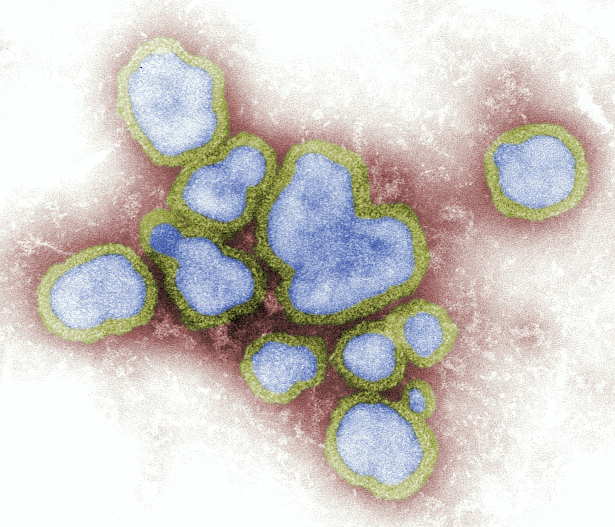 This digitally-colorized, negative-stained transmission electron microscopic (TEM) image depicted a number of Influenza A virions.