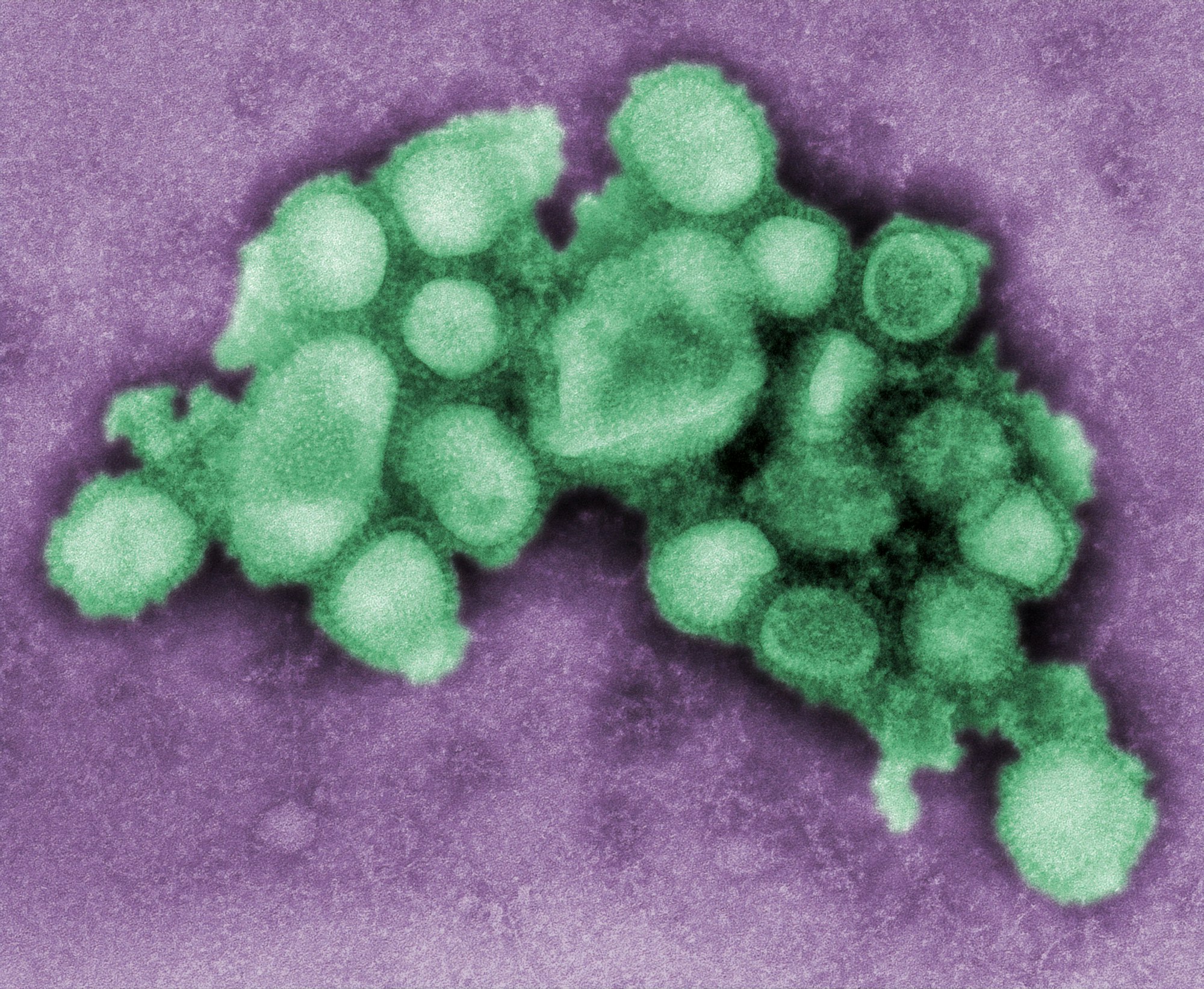 This digitally-colorized, negative-stained transmission electron microscopic (TEM) image depicted some of the ultrastructural morphology of the A/CA/4/09 Swine Flu virus.