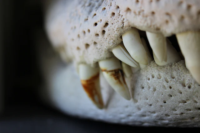 Enfermedad periodontal
