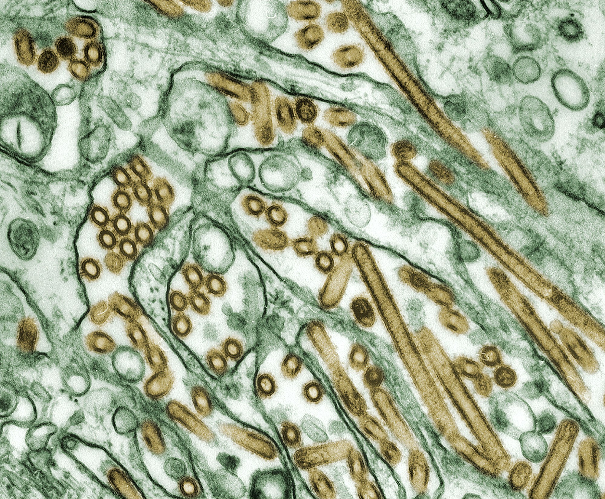 This 1997 image depicts a digitally-colorized transmission electron microscopic (TEM) image of Avian Influenza A H5N1 viruses (seen in gold), grown in Madin-Darby Canine Kidney (MDCK) epithelial cells (seen in green) .