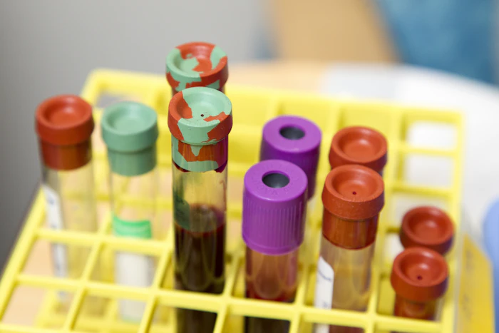 Tubos de ensaio de laboratório