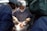A group of surgeons are performing an operation in a well-equipped, sterile environment. The focus is on the patient's open chest cavity where the surgical procedure is taking place. Surgeons are wearing blue surgical scrubs, masks, and caps. Bright lighting is used to illuminate the area being operated on.