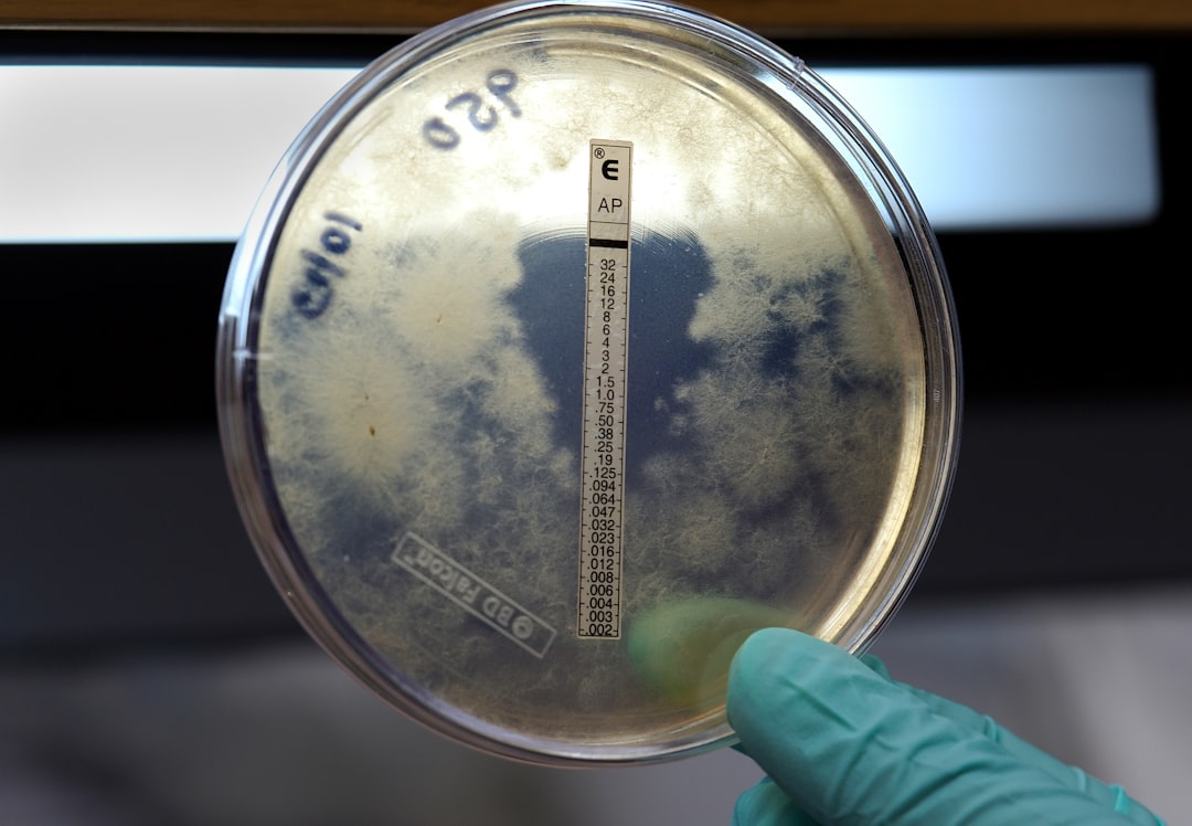Captured during the Centers for Disease Control and Prevention’s (CDC) multistate meningitis outbreak investigation, this plate revealed the results of a susceptibility test to the antifungal drug, amphotericin B. The drug inhibited growth of the fungal organism, of the genus Exserohilum, evidenced by the clear area, where the amphotericin B had diffused into the medium, while elsewhere on the plate, where the amphotericin B had not diffused, the Exserohilum organisms were still growing.