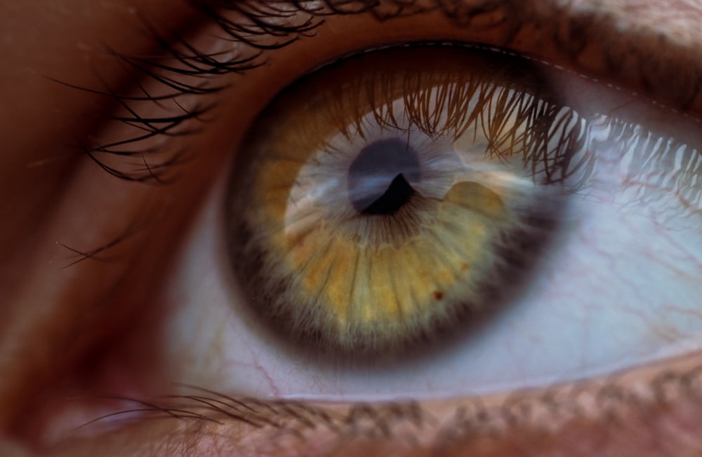 a close up of a person's eye with a yellow iris