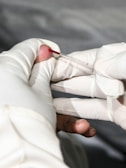 A gloved hand is holding a small lancet near a person's fingertip, with a drop of blood visible on the finger. The focus is on the finger prick procedure.