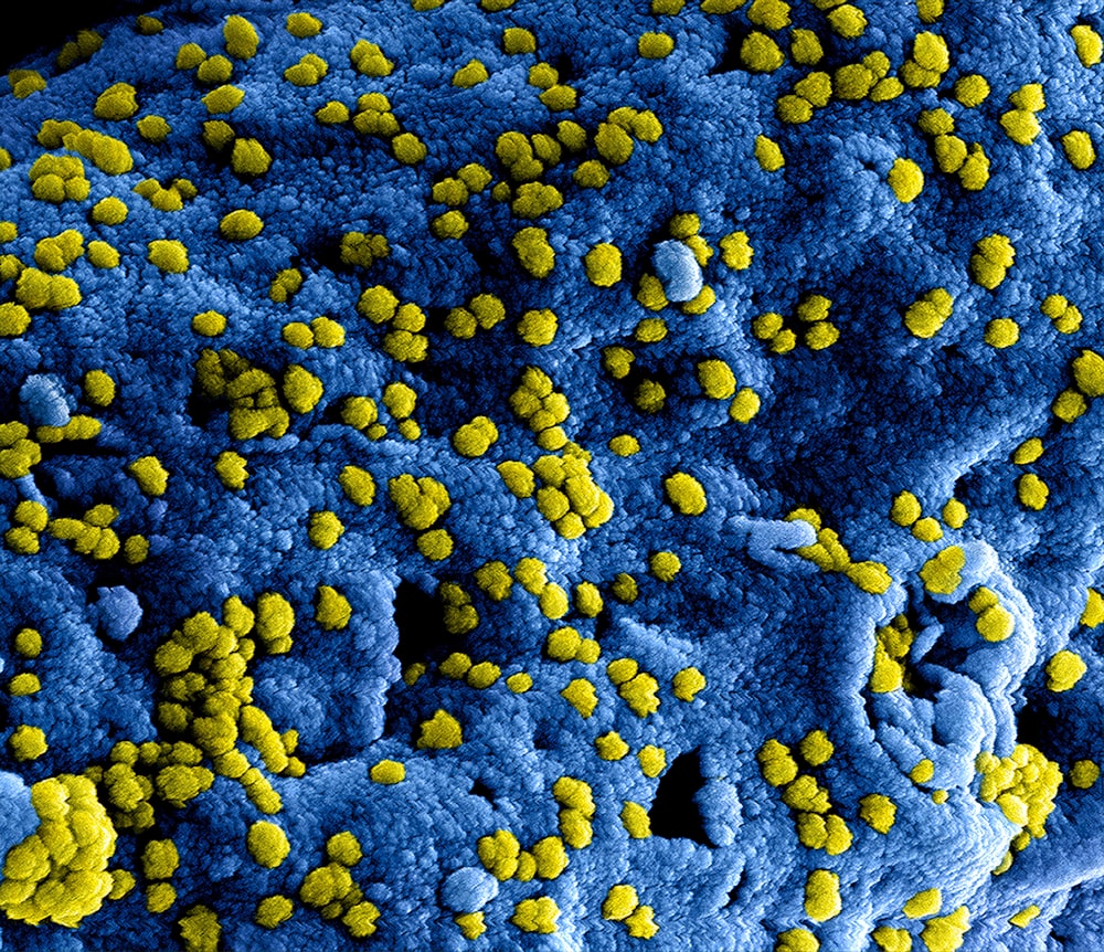 a blue and yellow substance with yellow dots