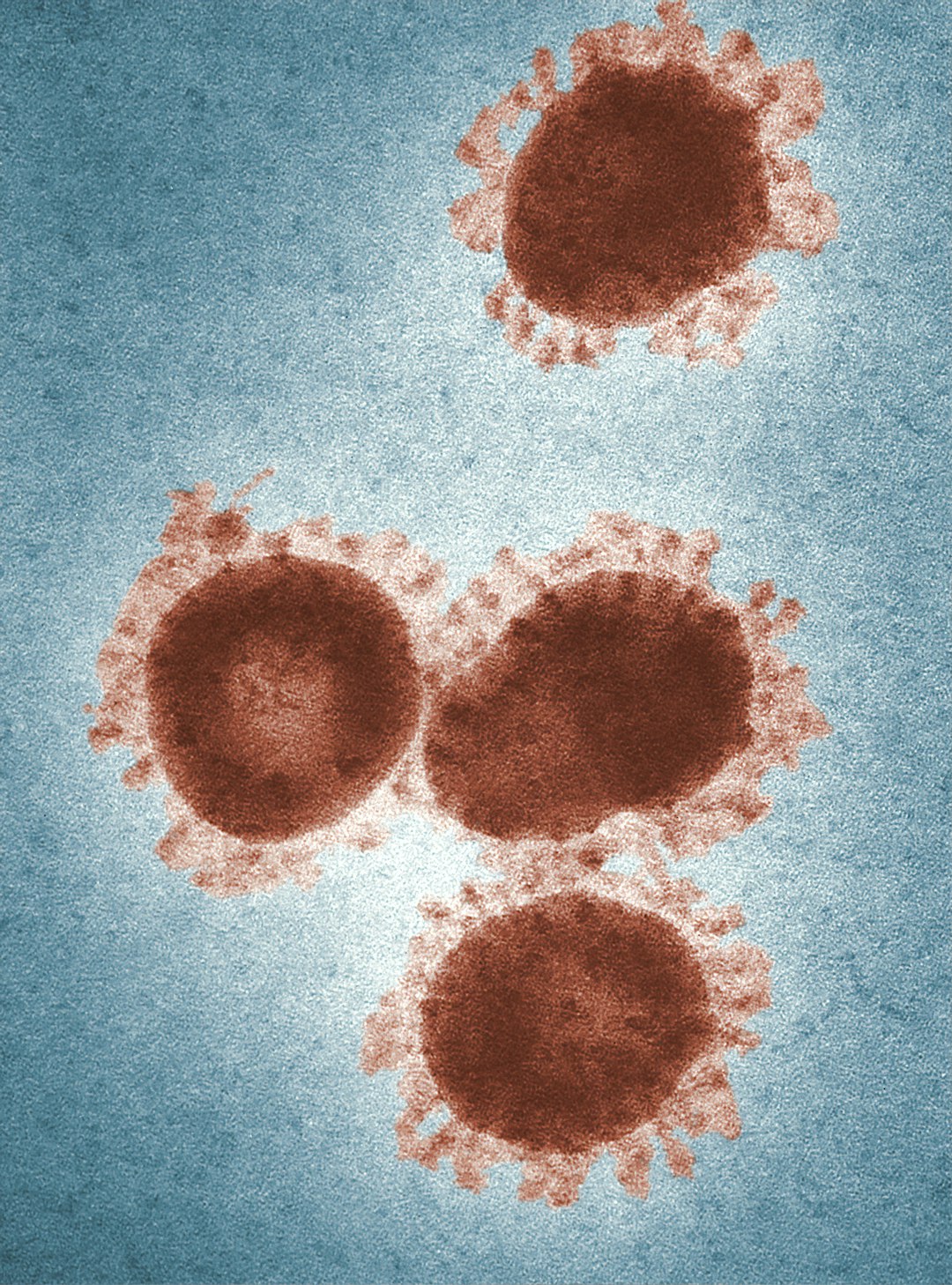 This 1975, digitally colorized transmission electron microscopic (TEM) image, depicted four avian infectious bronchitis virus (IBV) virions, which are Coronaviridae family members. IBV is a highly contagious pathogen, which infects poultry of all ages, affecting a number of organ systems, including the respiratory and urogenital organs. IBV possesses a helical genome, composed of non-segmented, positive-sense single-stranded RNA ((+) ssRNA). This is an enveloped virus, which means that its outermost covering is derived from the host cell membrane. The coronavirus derives its name from the fact