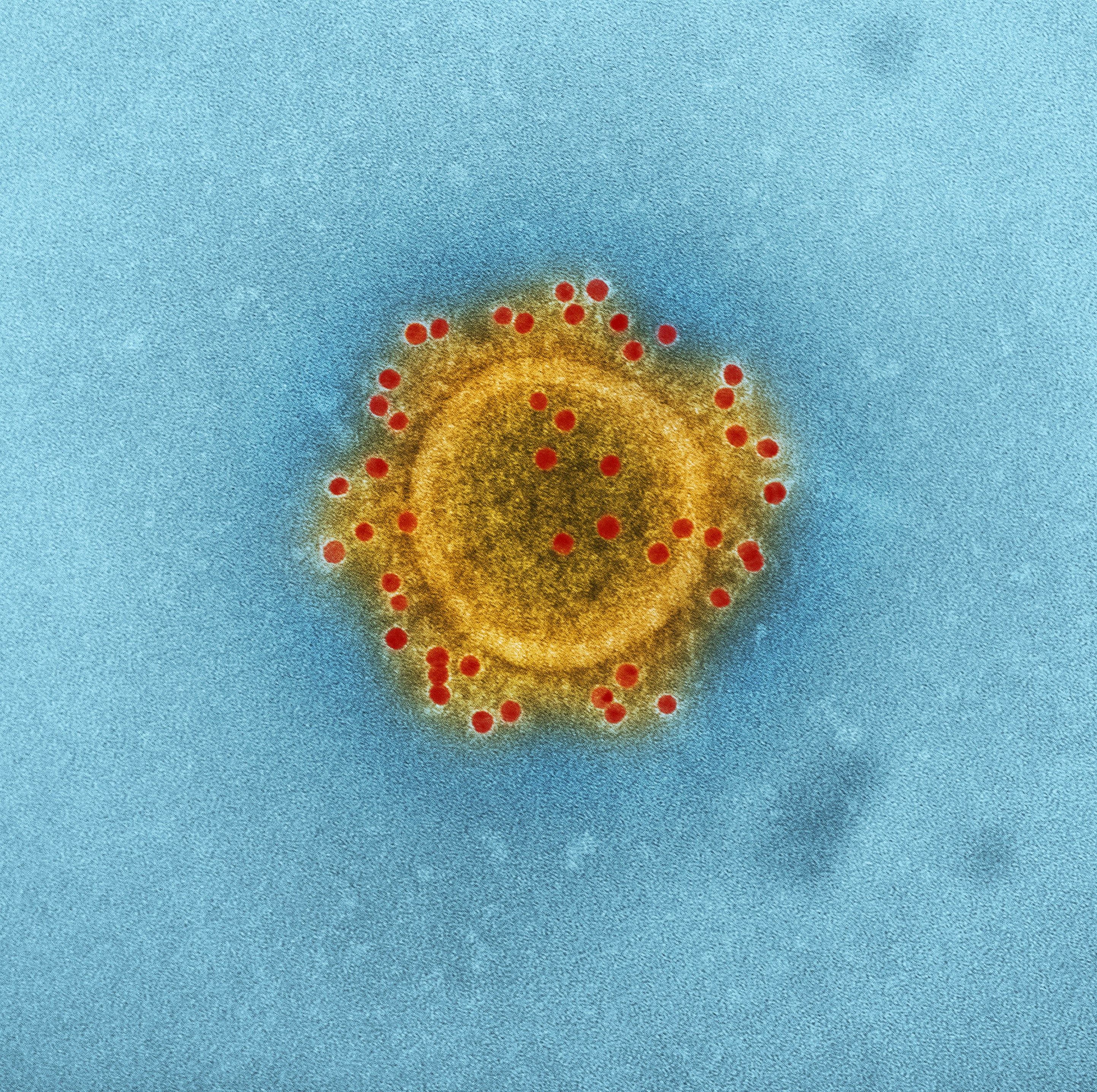 Diagram of a urinary tract infection