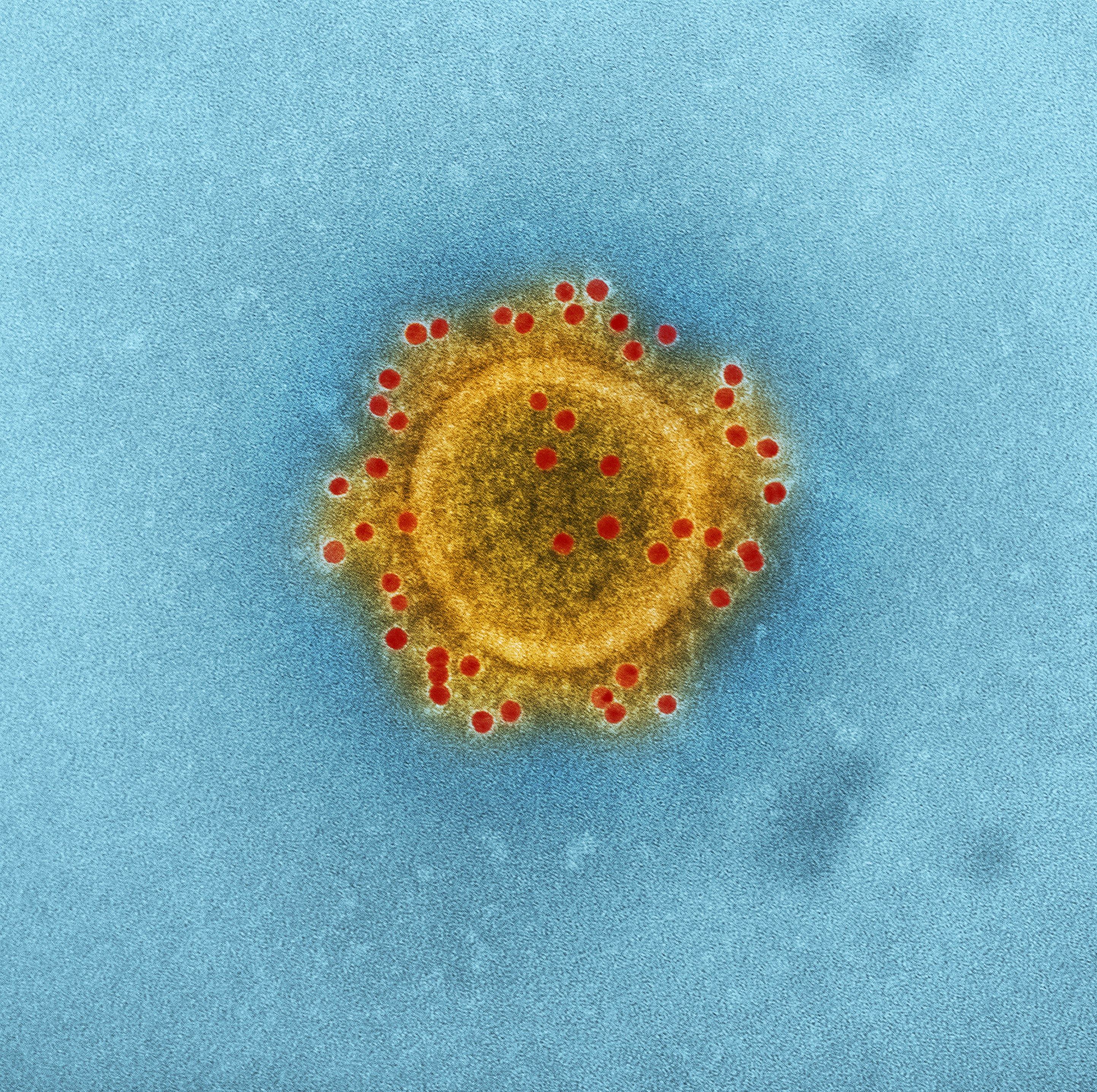Produced by the National Institute of Allergy and Infectious Diseases (NIAID), this highly magnified, digitally colorized transmission electron microscopic (TEM) image highlights the particle envelope of a single, spherical shaped, Middle East respiratory syndrome coronavirus (MERS-CoV) virion, through the process of immunolabeling, the envelope proteins, using rabbit HCoV-EMC/2012 primary antibody, and goat anti-rabbit 10nm gold particles.