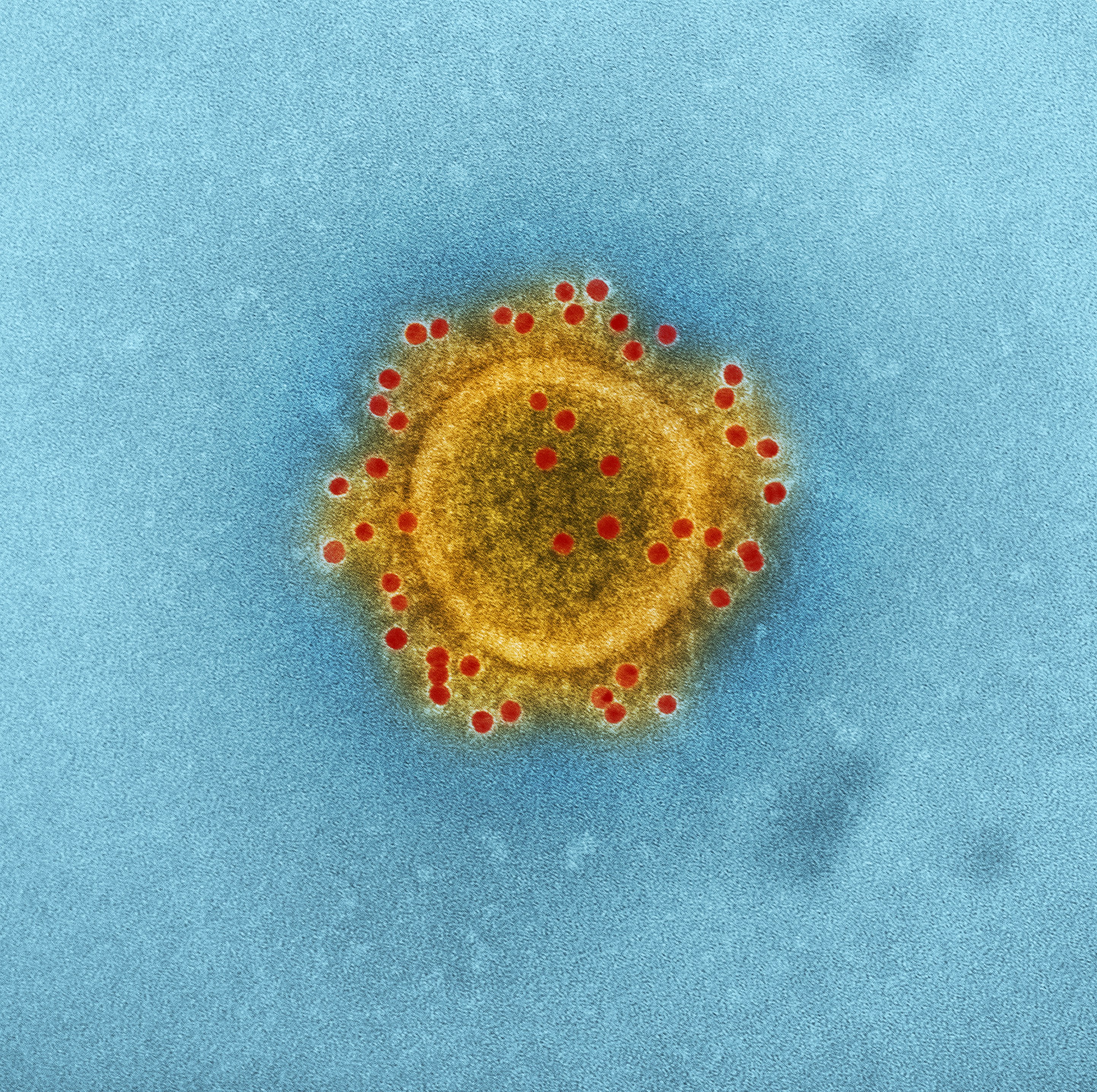&quot;Produced by the National Institute of Allergy and Infectious Diseases (NIAID), this highly magnified, digitally colorized transmission electron microscopic (TEM) image highlights the particle envelope of a single, spherical shaped, Middle East respiratory syndrome coronavirus (MERS-CoV) virion, through the process of immunolabeling, the envelope proteins, using rabbit HCoV-EMC\/2012 primary antibody, and goat anti-rabbit 10nm gold particles.&quot;