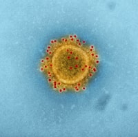 &quot;Produced by the National Institute of Allergy and Infectious Diseases (NIAID), this highly magnified, digitally colorized transmission electron microscopic (TEM) image highlights the particle envelope of a single, spherical shaped, Middle East respiratory syndrome coronavirus (MERS-CoV) virion, through the process of immunolabeling, the envelope proteins, using rabbit HCoV-EMC\/2012 primary antibody, and goat anti-rabbit 10nm gold particles.&quot;