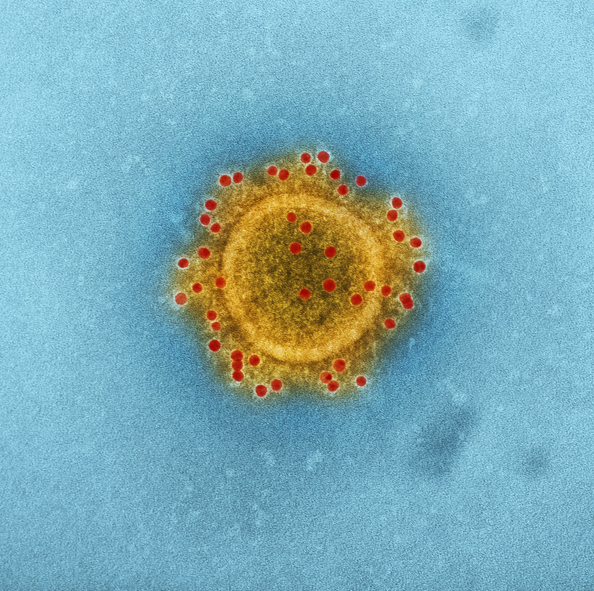 Produced by the National Institute of Allergy and Infectious Diseases (NIAID), this highly magnified, digitally colorized transmission electron microscopic (TEM) image highlights the particle envelope of a single, spherical shaped, Middle East respiratory syndrome coronavirus (MERS-CoV) virion, through the process of immunolabeling, the envelope proteins, using rabbit HCoV-EMC/2012 primary antibody, and goat anti-rabbit 10nm gold particles.