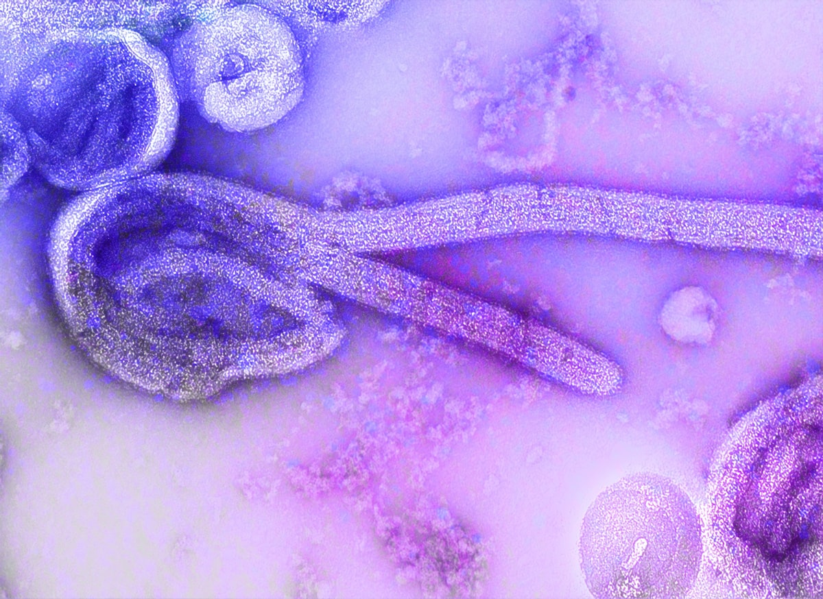 Why does the Ebola virus look like a worm?