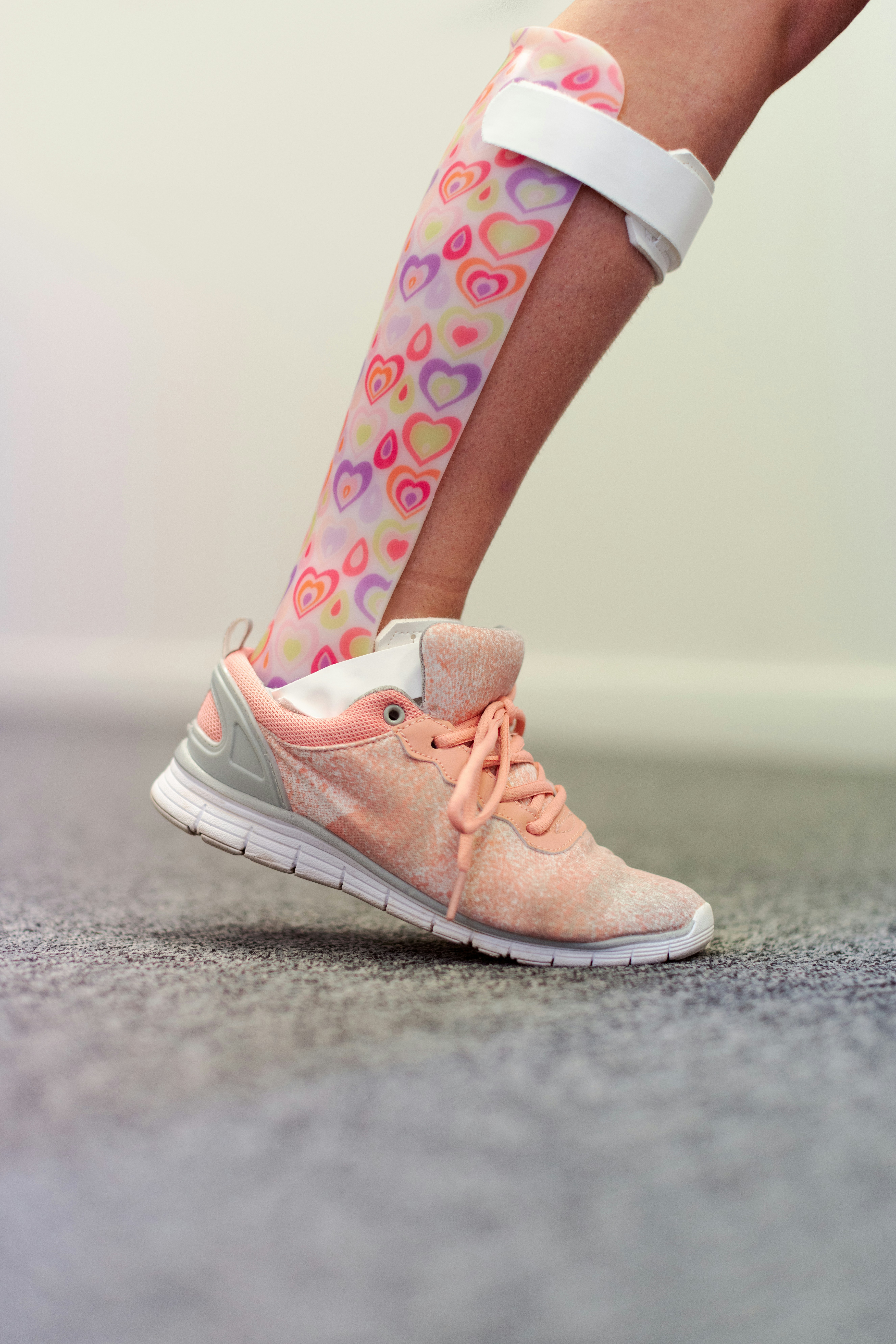 Personalised splint helps patient walk