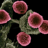 Test drugs/combinatory therapies for bone marrow malignancies and disorders 