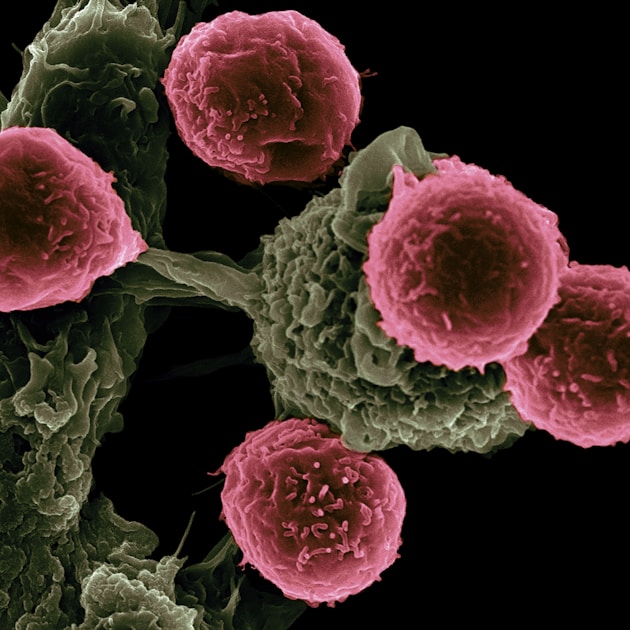 Colorectal Cancer Screening Age 45: Why Doctors Lowered It and What to Do Now