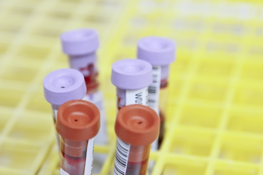 Unpacking the link between blood type A, genes, and early-onset strokes (EOS) in young adults (18-59