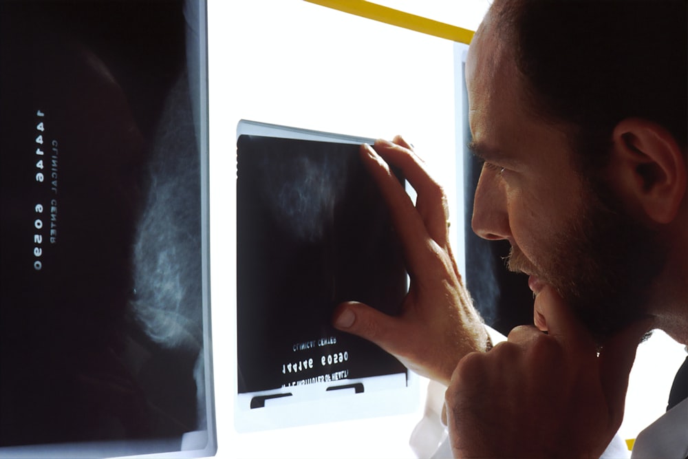 A doctor looking at an x-ray, symbolizing surprising signs of prostate issues