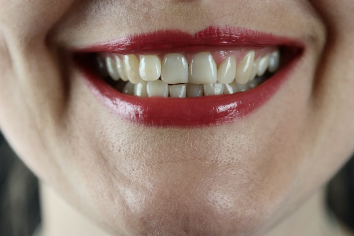 Whiter, Brighter, Happier The Journey of Teeth Whitening