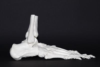 A 3D model of a human knee joint displayed on a white background.