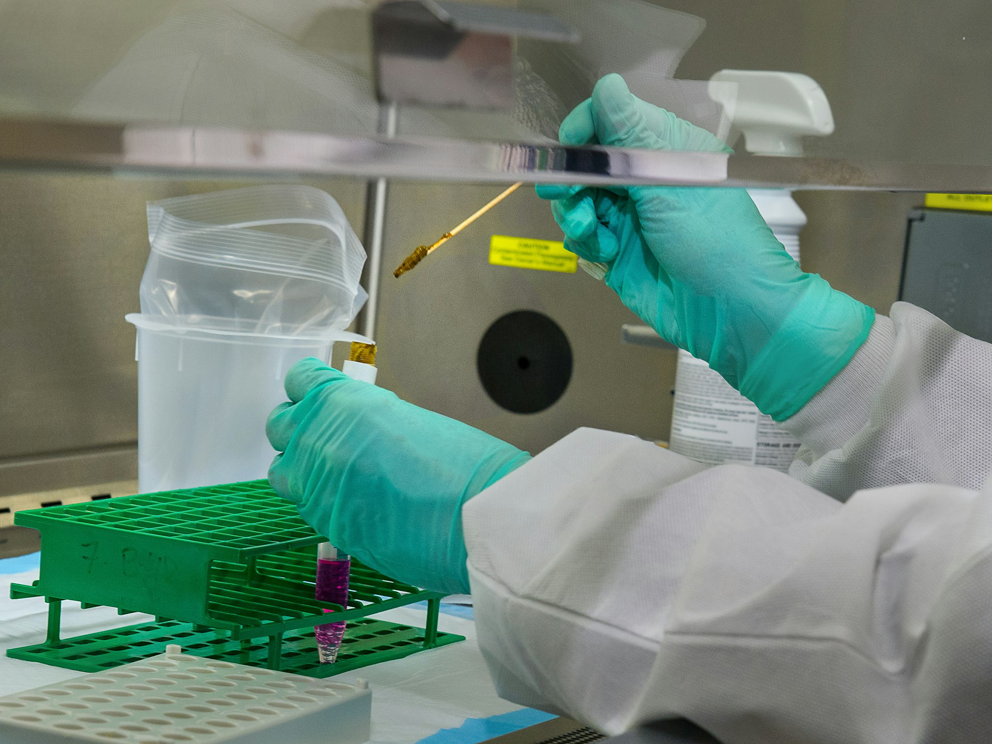 To mix the stool and the chemicals together, this Centers for Disease Control and Prevention (CDC) scientist was shown adding a stool sample to the cell culture medium, along with glass beads, which will suspending the stool in the solution. Then the scientist will shake the test tube, in order to get the stool to come off the glass beads, and disperse throughout the liquid. 