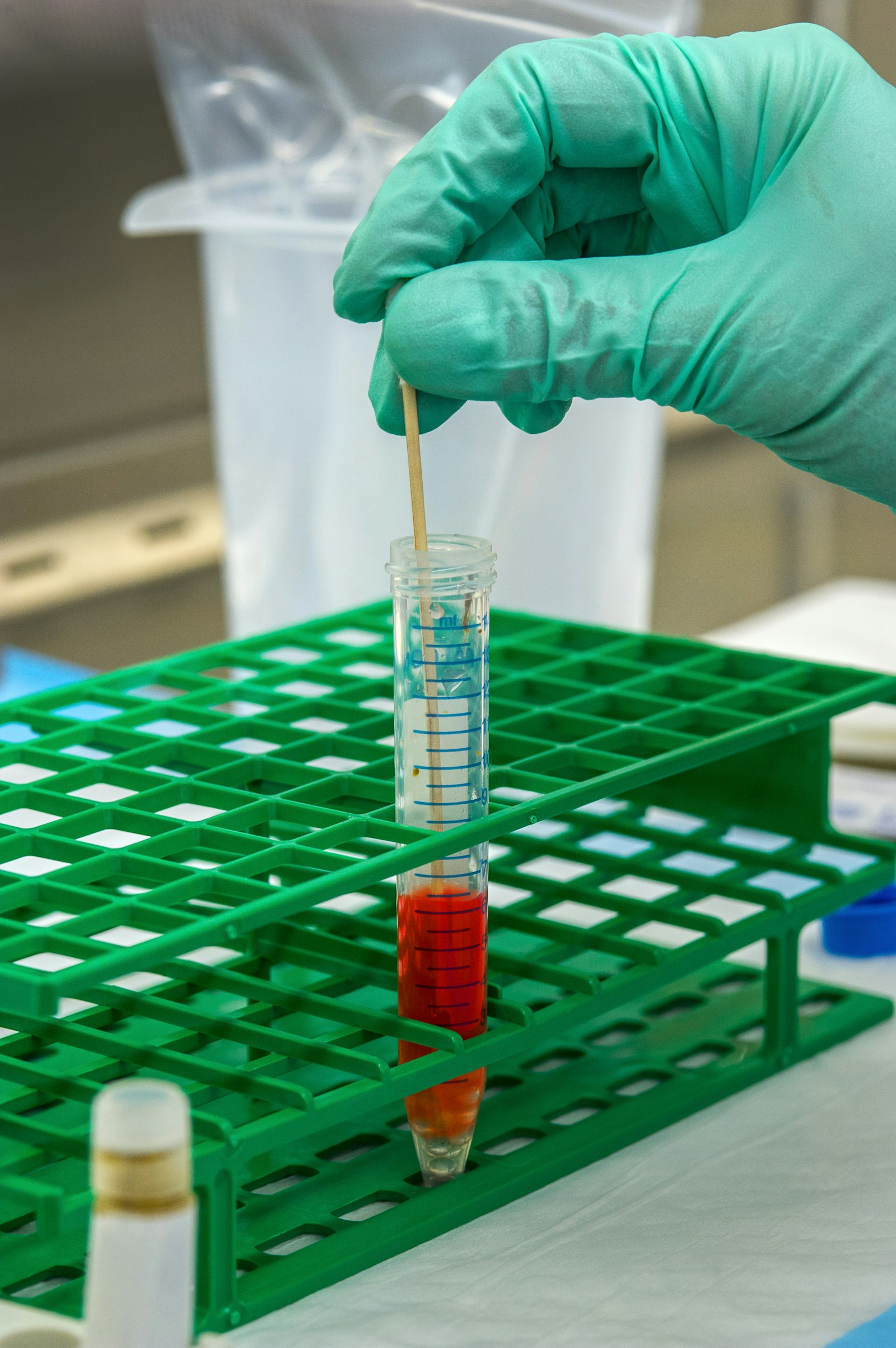 Hypothyroidism in 2026: Symptoms, TSH Testing and Treatment Explained